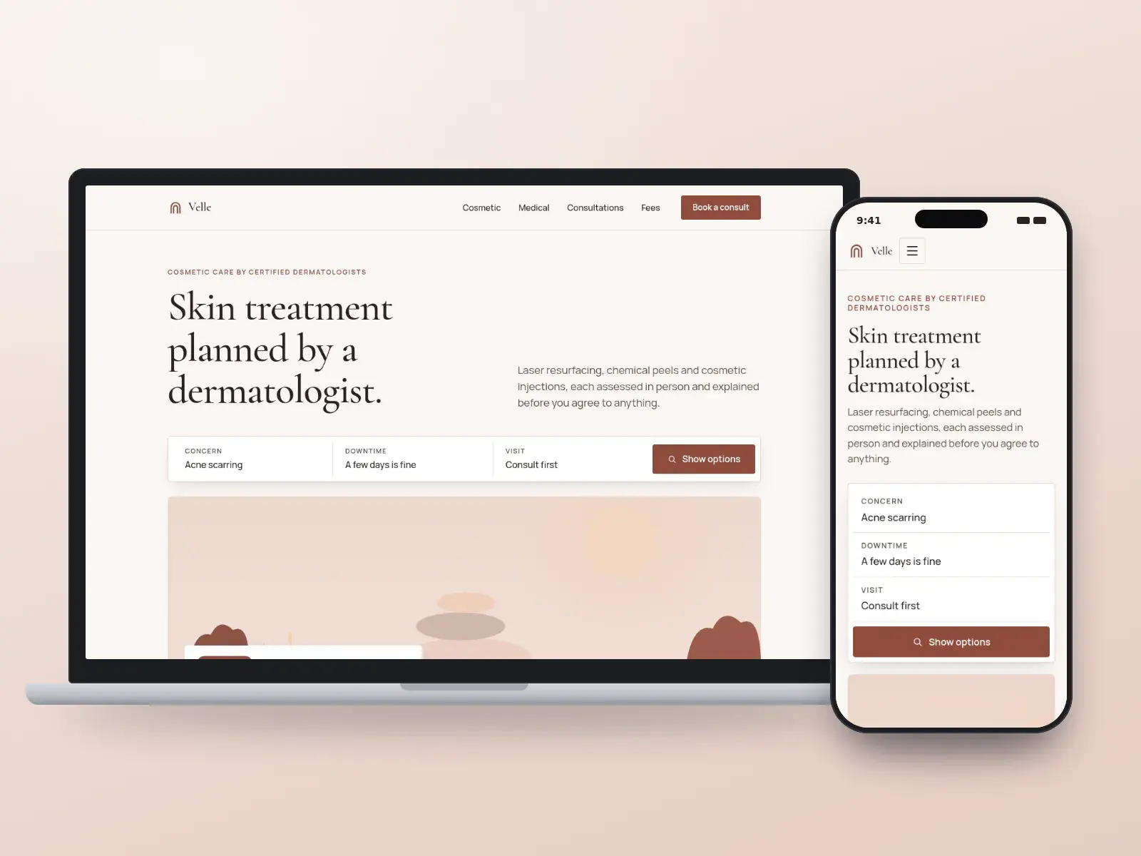 Velle Skin and Dermatology, a blush and bone cosmetic dermatology website with a treatment finder above a soft treatment-room illustration, shown on a laptop and a phone.